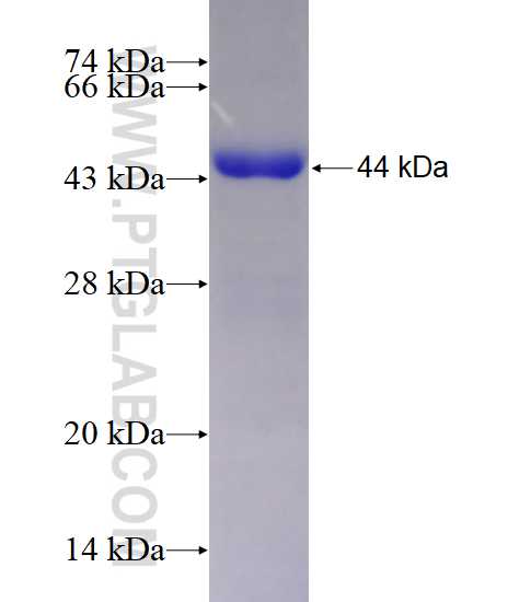 GPT2 fusion protein Ag10360 SDS-PAGE