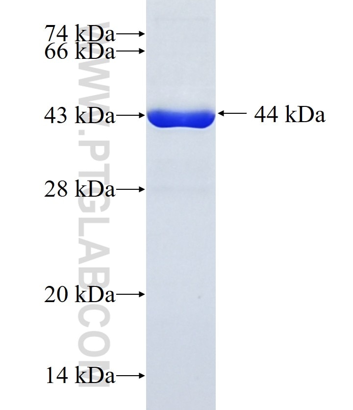 GPT2 fusion protein Ag10360 SDS-PAGE