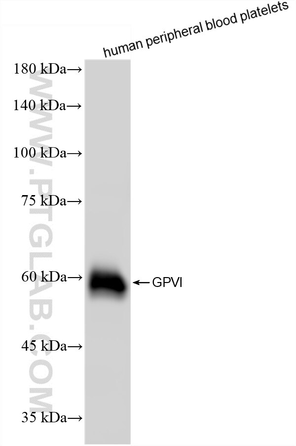 Western Blot (WB) analysis of human peripheral blood platelets using GPVI Recombinant monoclonal antibody (87275-3-RR)