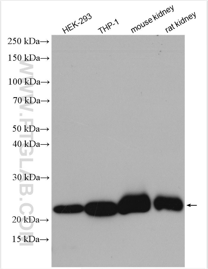 Western Blot (WB) analysis of various lysates using GPX1 Polyclonal antibody (29329-1-AP)