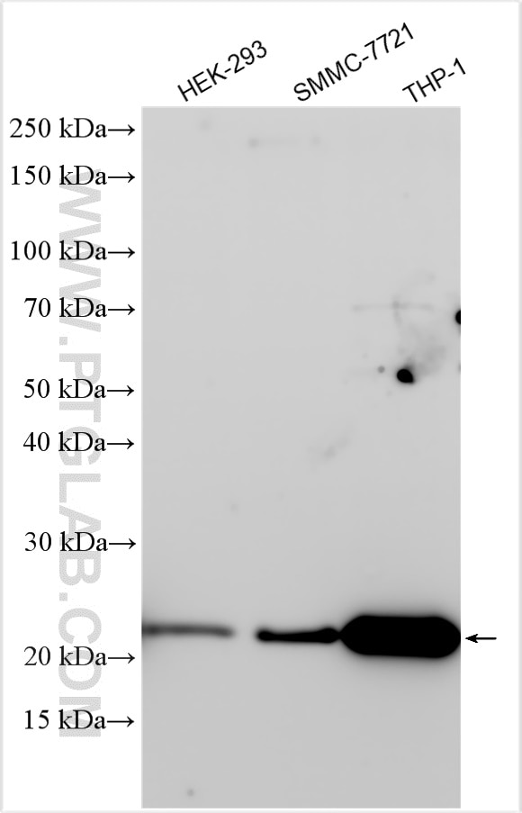 Western Blot (WB) analysis of various lysates using GPX1 Polyclonal antibody (29329-1-AP)