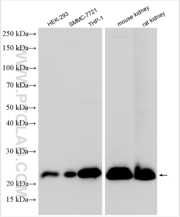 Western Blot (WB) analysis of various lysates using GPX1 Polyclonal antibody (29329-1-AP)