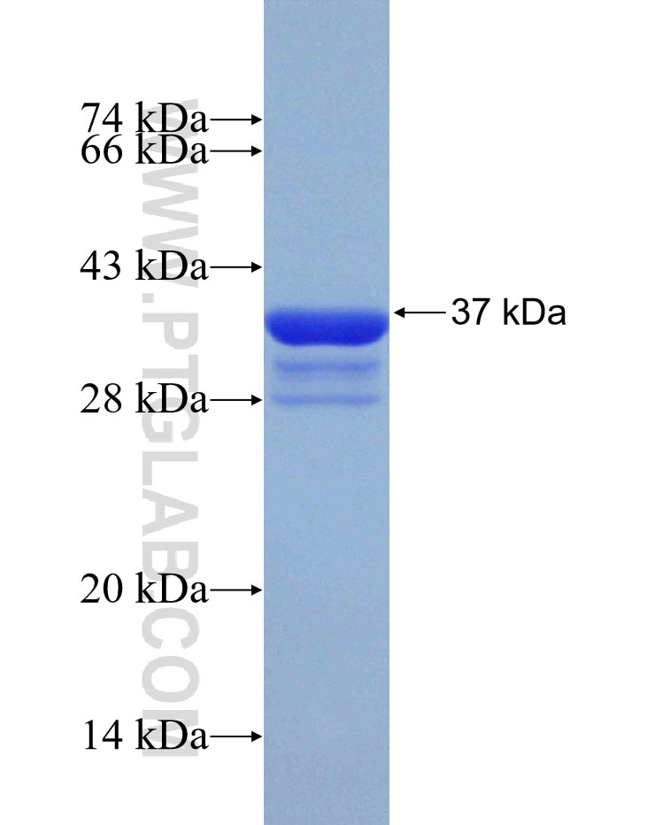 GPX1 fusion protein Ag31101 SDS-PAGE