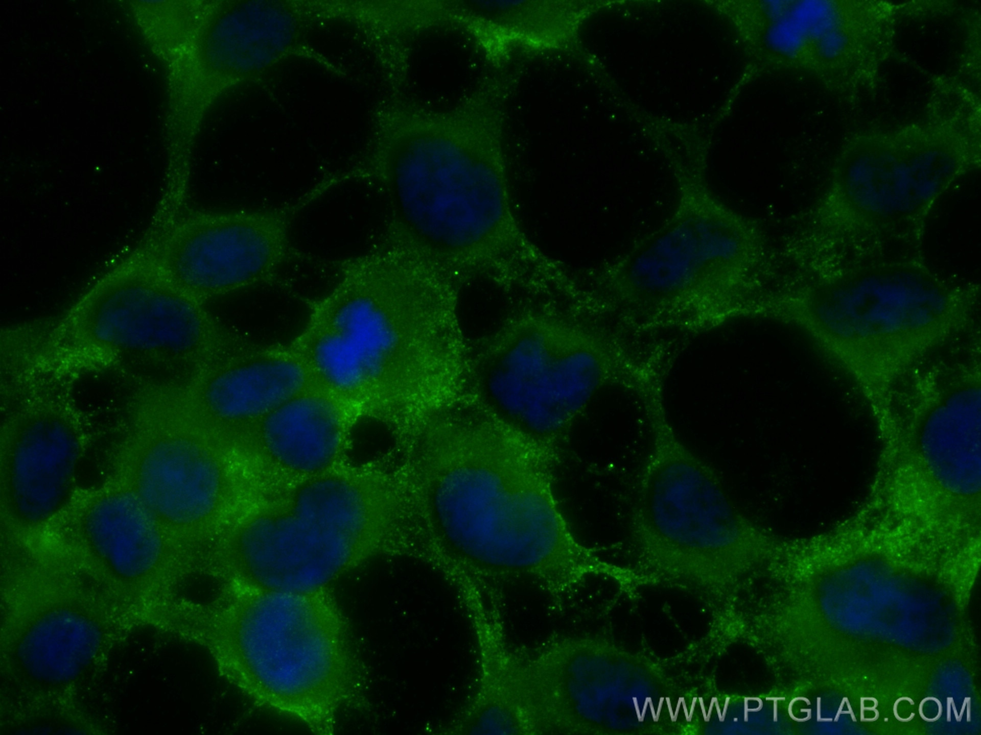 Immunofluorescence (IF) / fluorescent staining of HEK-293 cells using GPX3 Polyclonal antibody (13947-1-AP)