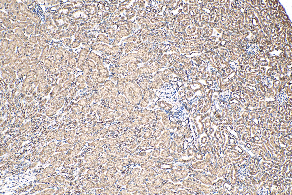 IHC staining of mouse kidney using 13947-1-AP