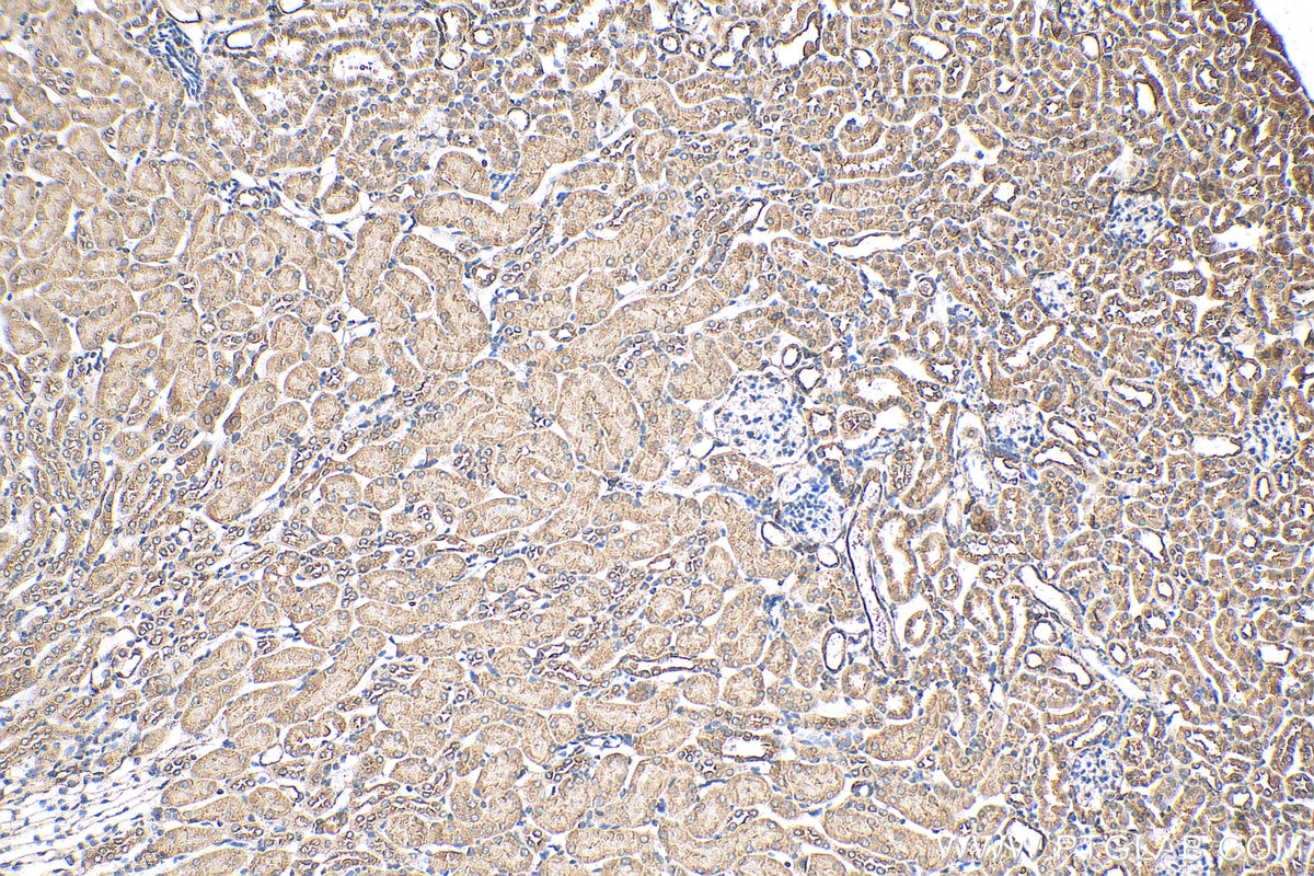 Immunohistochemistry (IHC) staining of mouse kidney tissue using GPX3 Polyclonal antibody (13947-1-AP)