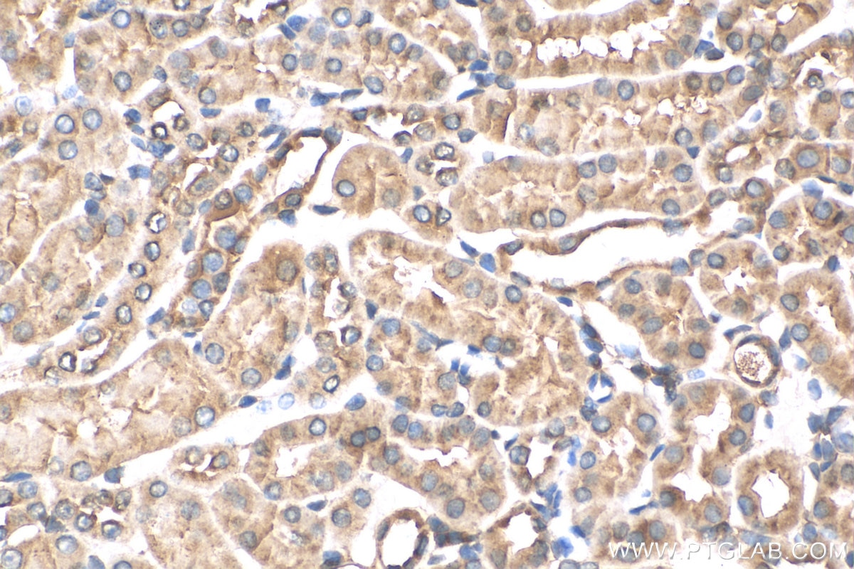 Immunohistochemistry (IHC) staining of mouse kidney tissue using GPX3 Polyclonal antibody (13947-1-AP)