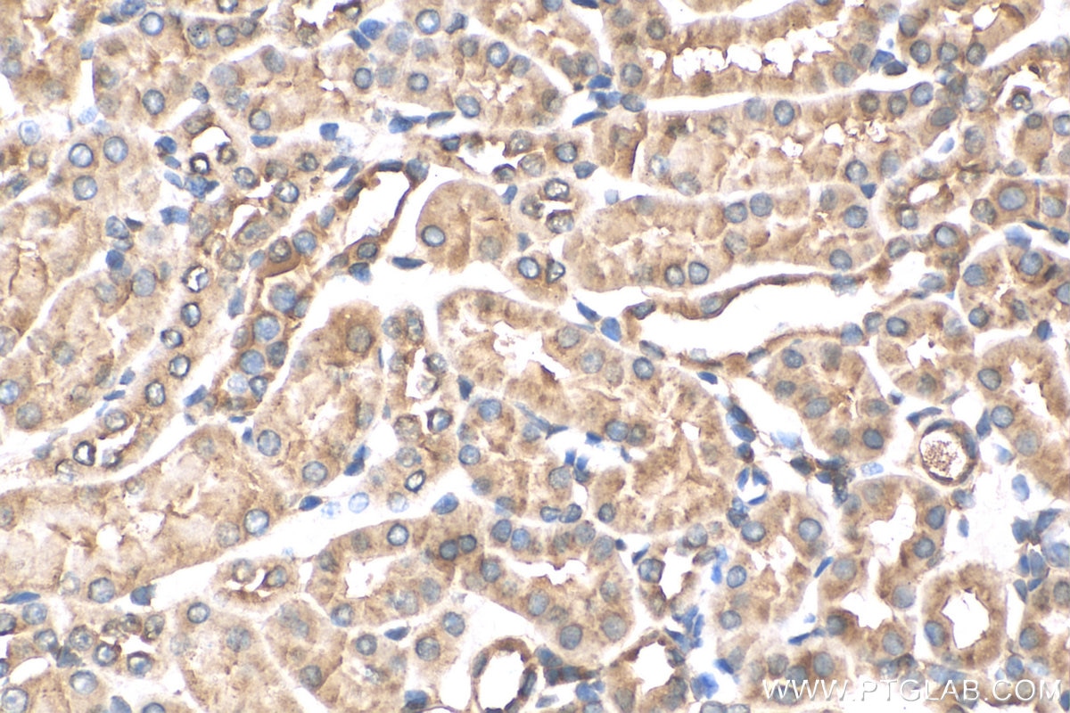 IHC staining of mouse kidney using 13947-1-AP