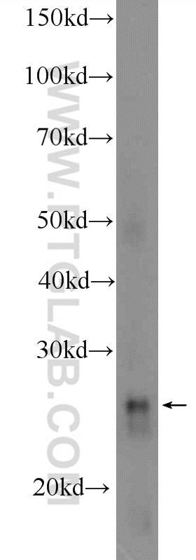 Western Blot (WB) analysis of mouse kidney tissue using GPX3 Polyclonal antibody (13947-1-AP)