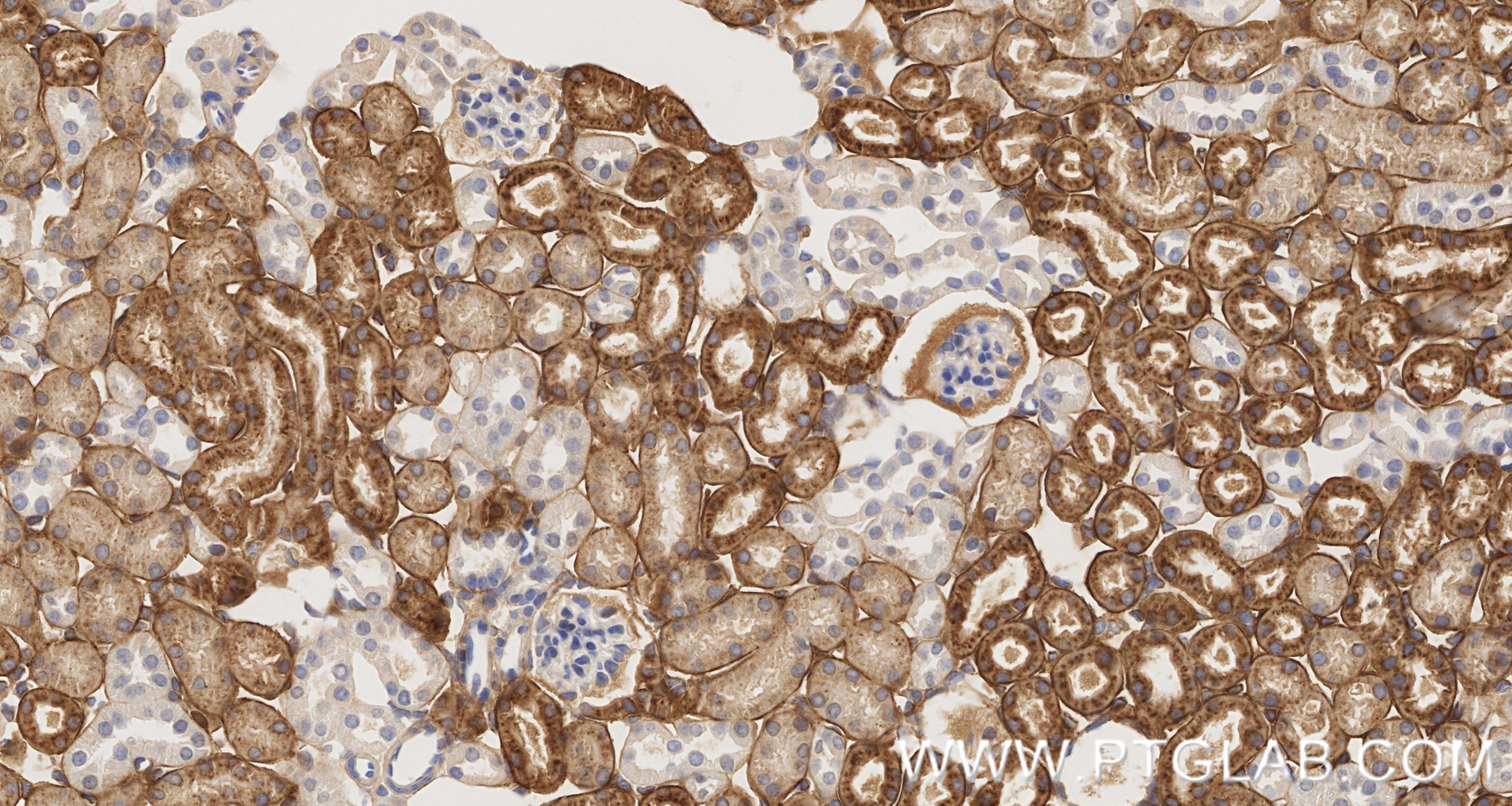 Immunohistochemistry (IHC) staining of mouse kidney tissue using GPX3 Recombinant monoclonal antibody (86650-2-RR)