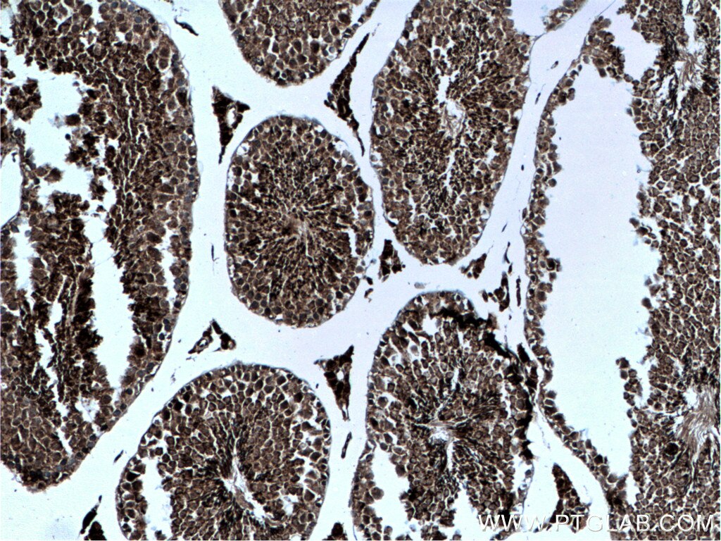 GPX4