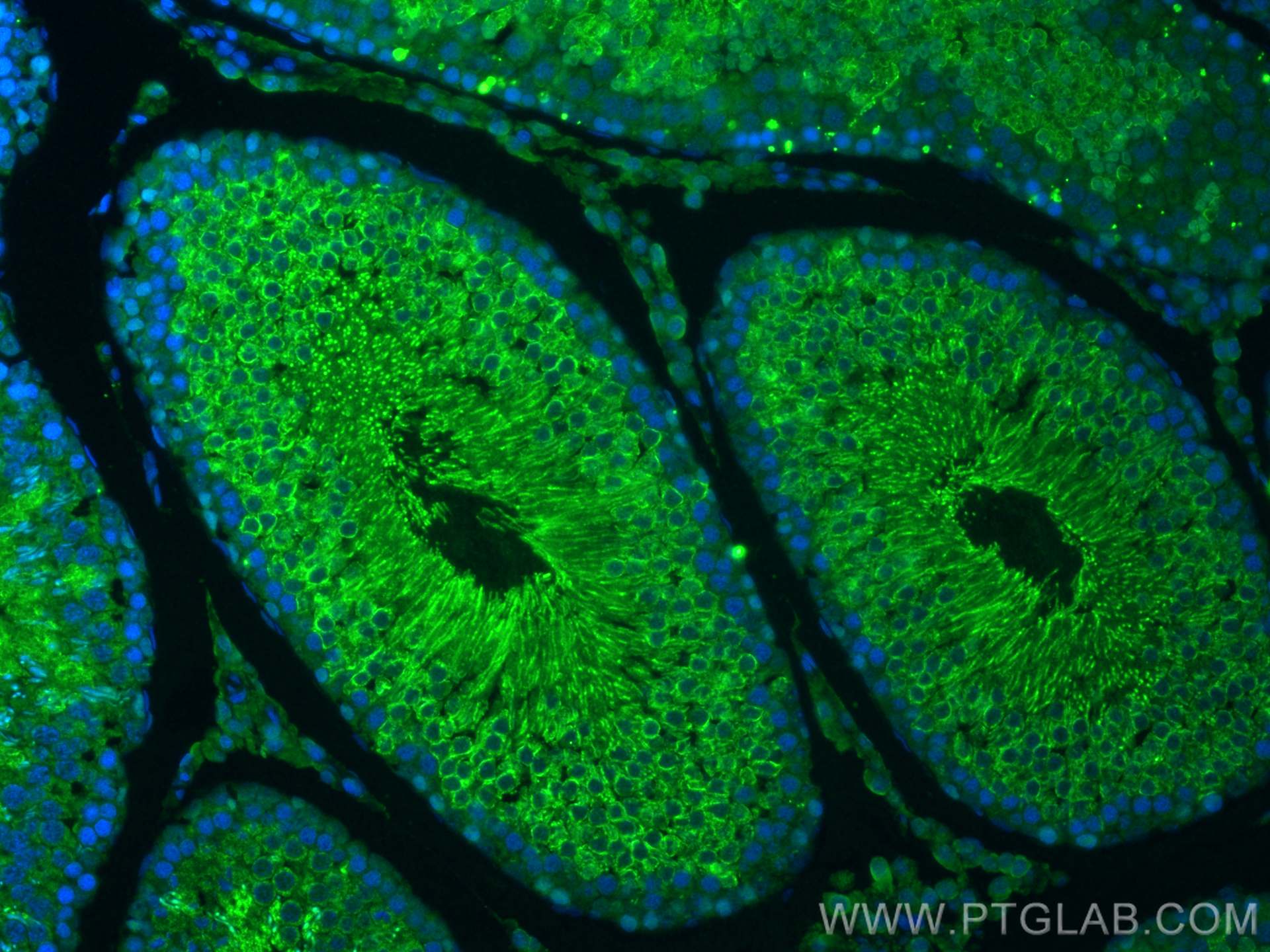 Immunofluorescence (IF) / fluorescent staining of rat testis tissue using GPX4 Polyclonal antibody (30388-1-AP)