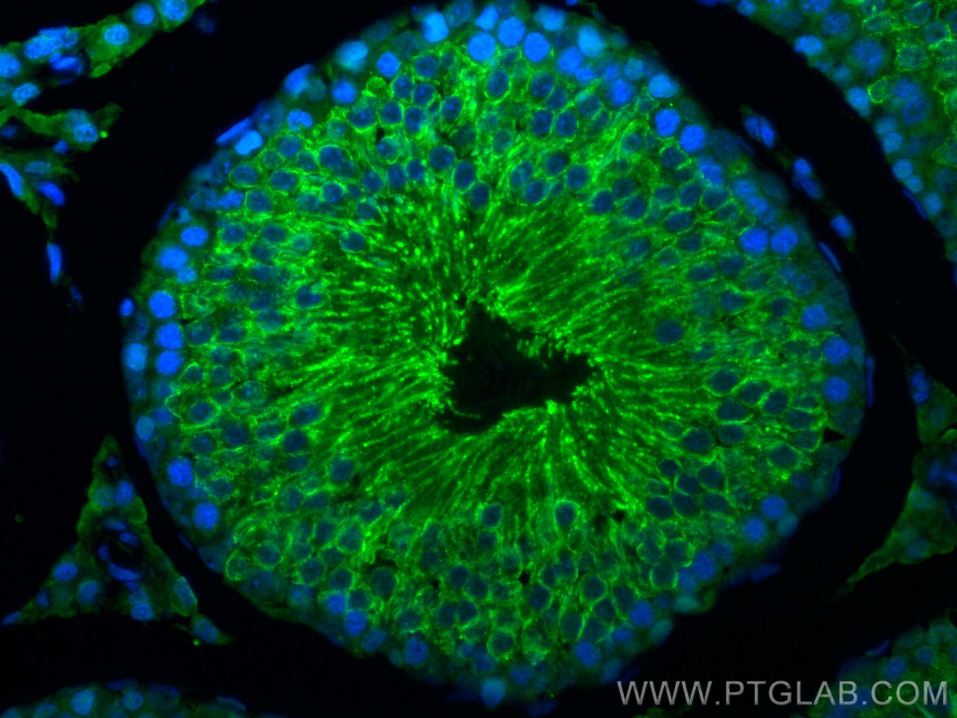 Immunofluorescence (IF) / fluorescent staining of rat testis tissue using GPX4 Polyclonal antibody (30388-1-AP)
