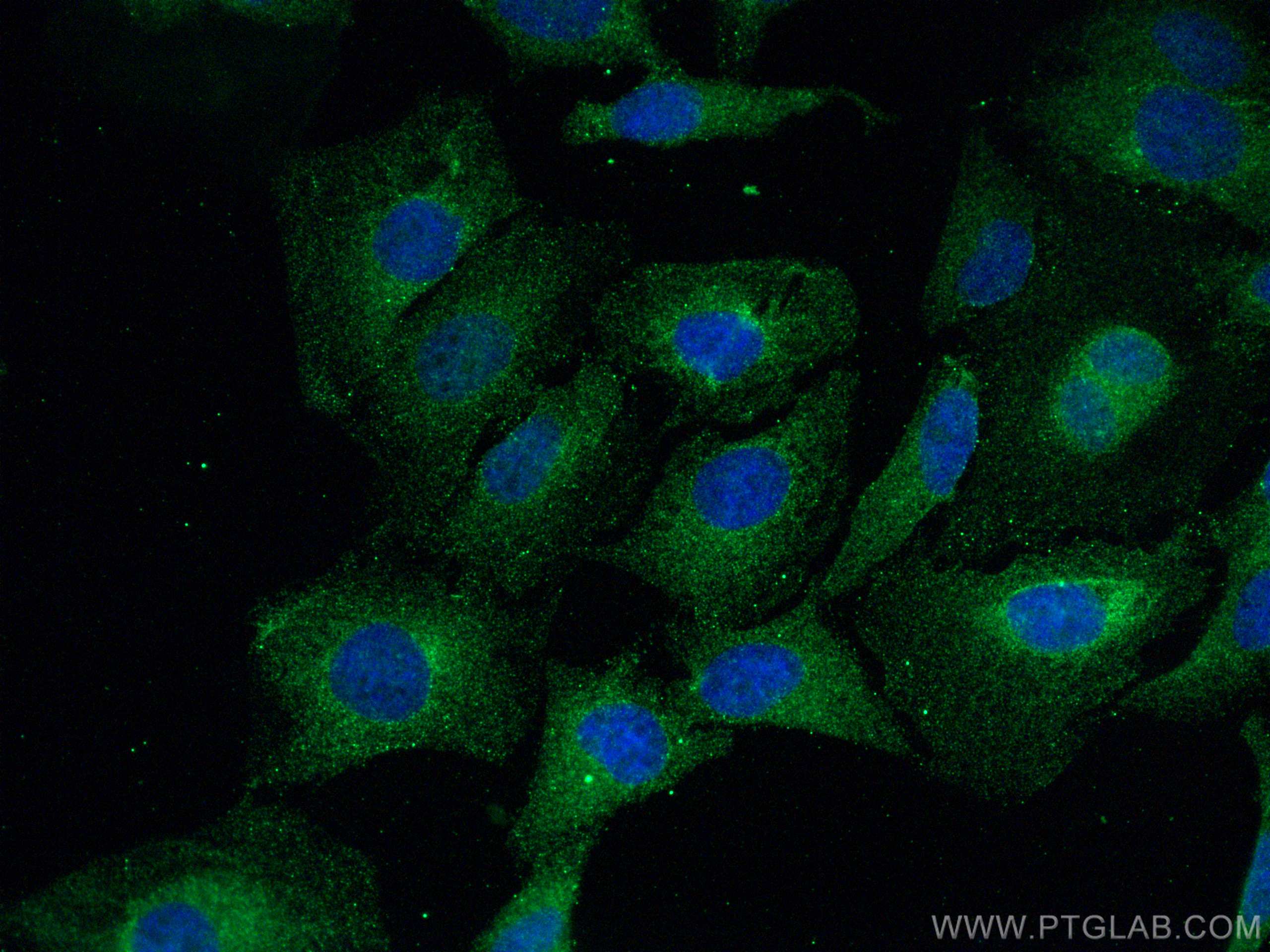 Immunofluorescence (IF) / fluorescent staining of HeLa cells using GPX4 Monoclonal antibody (67763-1-Ig)