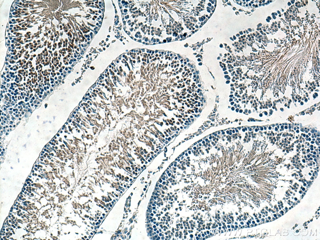 Immunohistochemistry (IHC) staining of rat testis tissue using GPX4 Monoclonal antibody (67763-1-Ig)