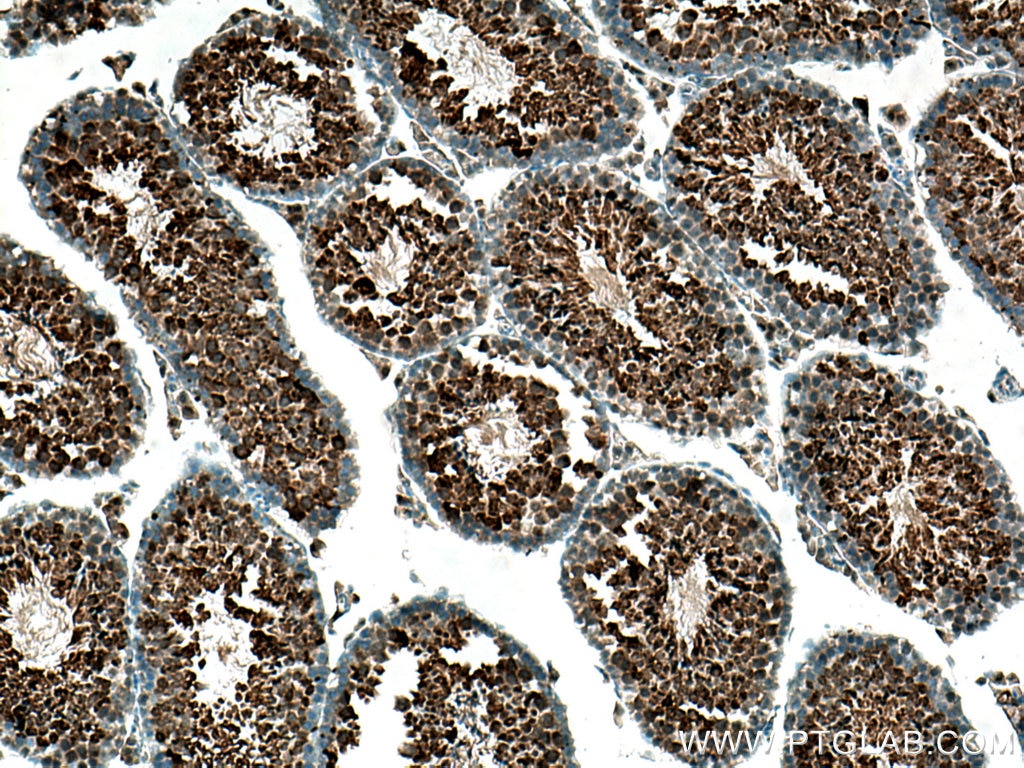 Immunohistochemistry (IHC) staining of mouse testis tissue using GPX4 Monoclonal antibody (67763-1-Ig)