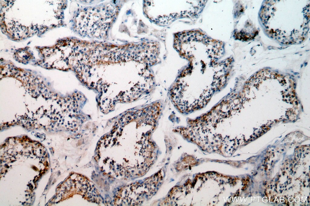 Immunohistochemistry (IHC) staining of human testis tissue using GPX5 Polyclonal antibody (18731-1-AP)