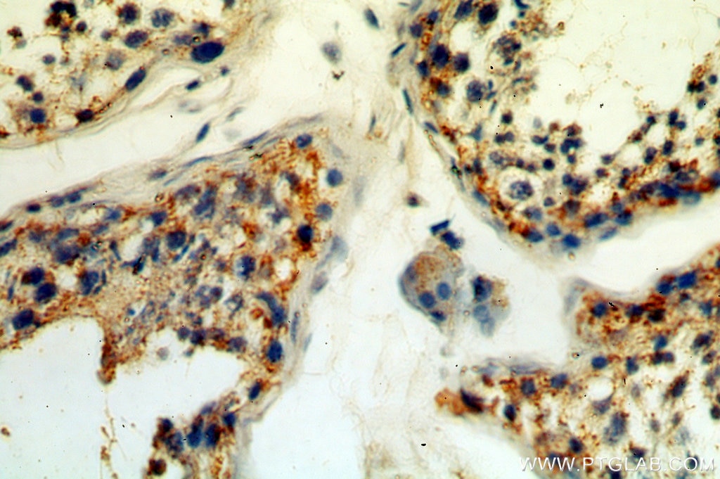 Immunohistochemistry (IHC) staining of human testis tissue using GPX5 Polyclonal antibody (18731-1-AP)
