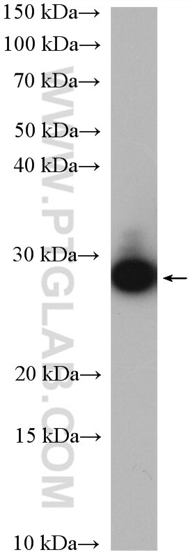 Western Blot (WB) analysis of PC-3 cells using GPX5 Polyclonal antibody (18731-1-AP)