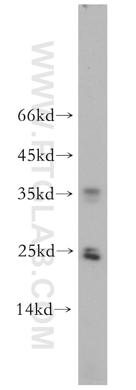 Western Blot (WB) analysis of mouse liver tissue using GPX5 Polyclonal antibody (18731-1-AP)