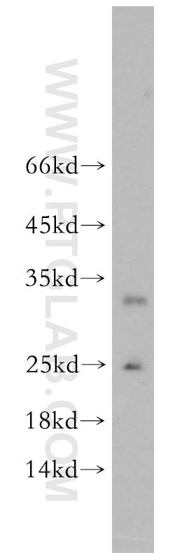 Western Blot (WB) analysis of human testis tissue using GPX5 Polyclonal antibody (18731-1-AP)