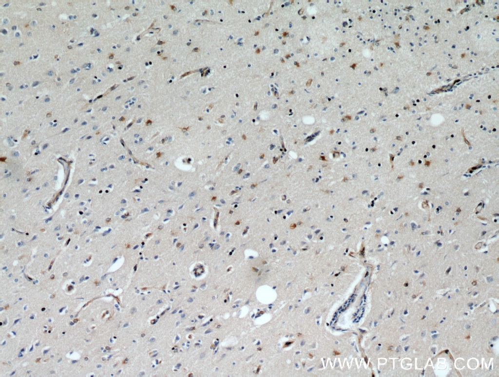 Immunohistochemistry (IHC) staining of human brain tissue using GPX7 Polyclonal antibody (13501-1-AP)