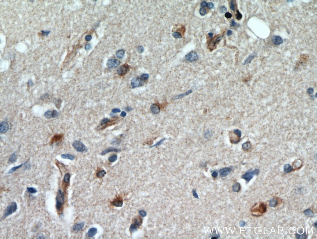IHC staining of human brain using 13501-1-AP