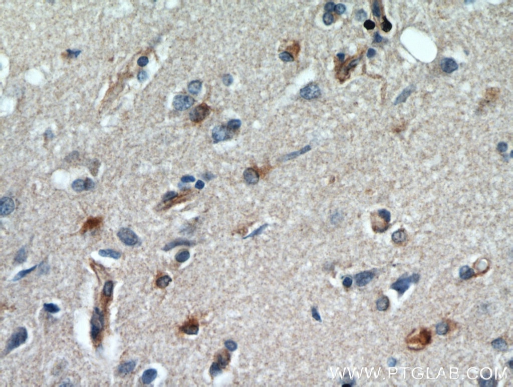 Immunohistochemistry (IHC) staining of human brain tissue using GPX7 Polyclonal antibody (13501-1-AP)