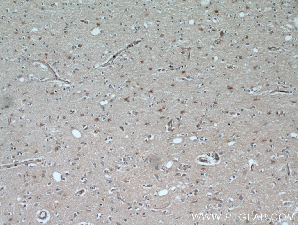 Immunohistochemistry (IHC) staining of human brain tissue using GPX7 Polyclonal antibody (13501-1-AP)