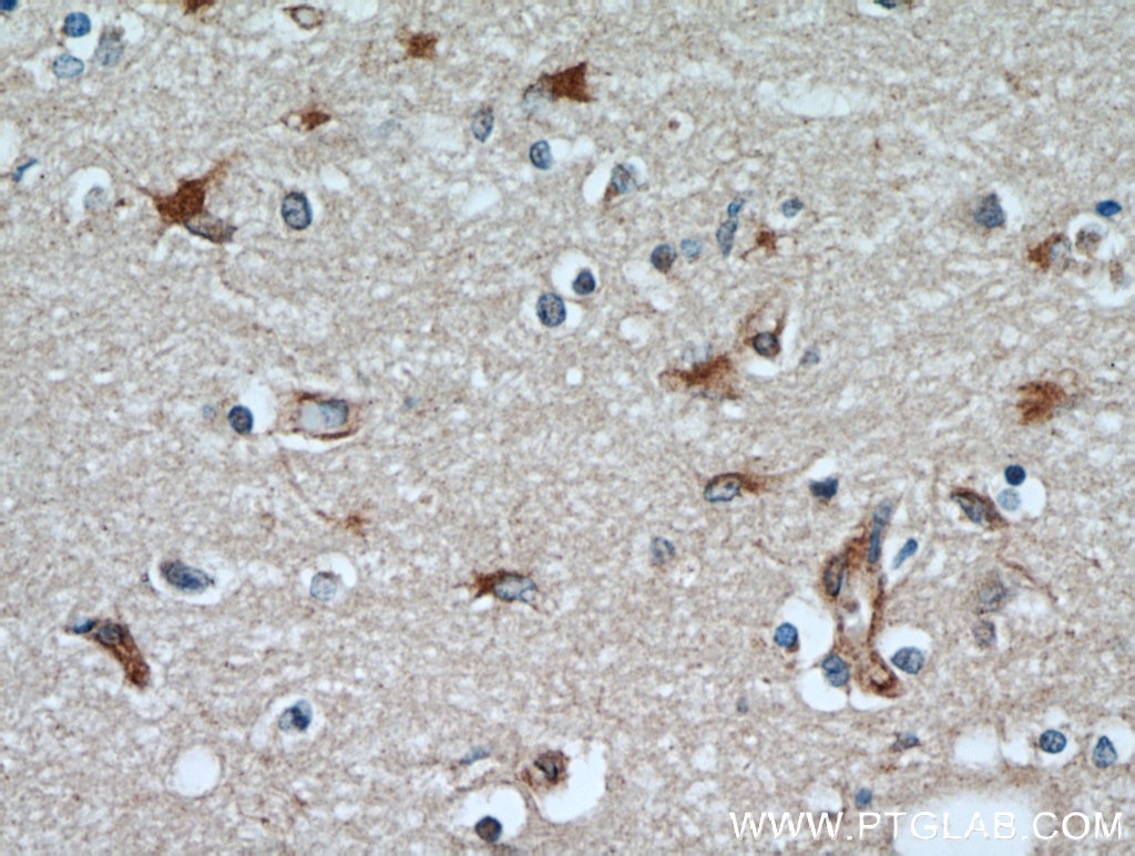 Immunohistochemistry (IHC) staining of human brain tissue using GPX7 Polyclonal antibody (13501-1-AP)