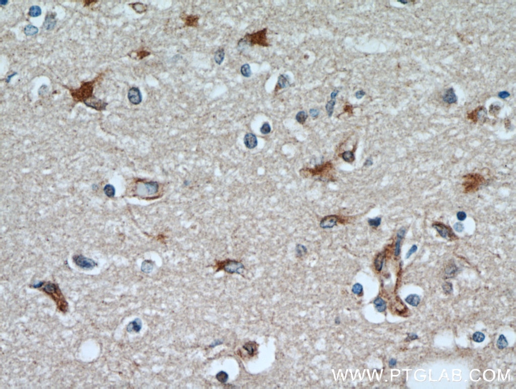 IHC staining of human brain using 13501-1-AP