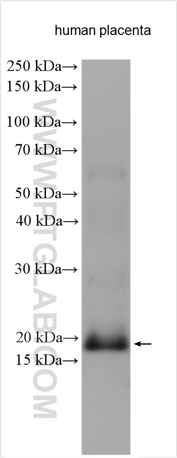 Western Blot (WB) analysis of various lysates using GPX7 Polyclonal antibody (13501-1-AP)