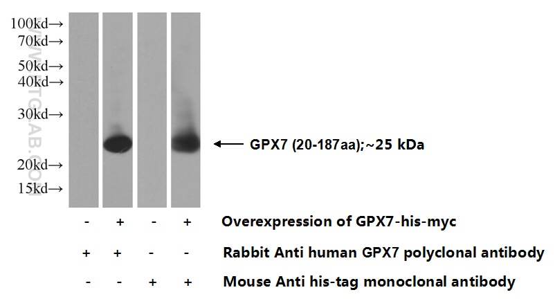 Western Blot (WB) analysis of Transfected HEK-293 cells using GPX7 Polyclonal antibody (13501-1-AP)