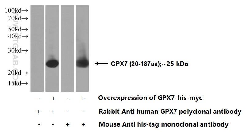 Western Blot (WB) analysis of Transfected HEK-293 cells using GPX7 Polyclonal antibody (13501-1-AP)