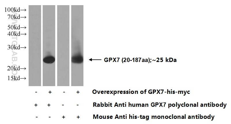 WB analysis of Transfected HEK-293 using 13501-1-AP