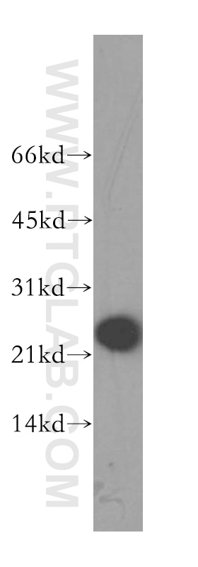 Western Blot (WB) analysis of human liver tissue using GPX7 Polyclonal antibody (13501-1-AP)