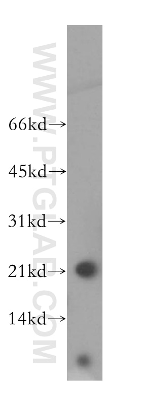 Western Blot (WB) analysis of human brain tissue using GPX7 Polyclonal antibody (13501-1-AP)