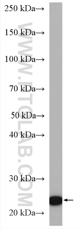 Western Blot (WB) analysis of U-251 cells using GPX8 Polyclonal antibody (16846-1-AP)