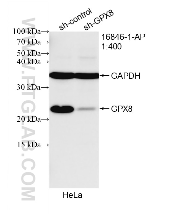 WB analysis of HeLa using 16846-1-AP Western Blot (WB) analysis of HeLa cells using GPX8 Polyclonal antibody (16846-1-AP)