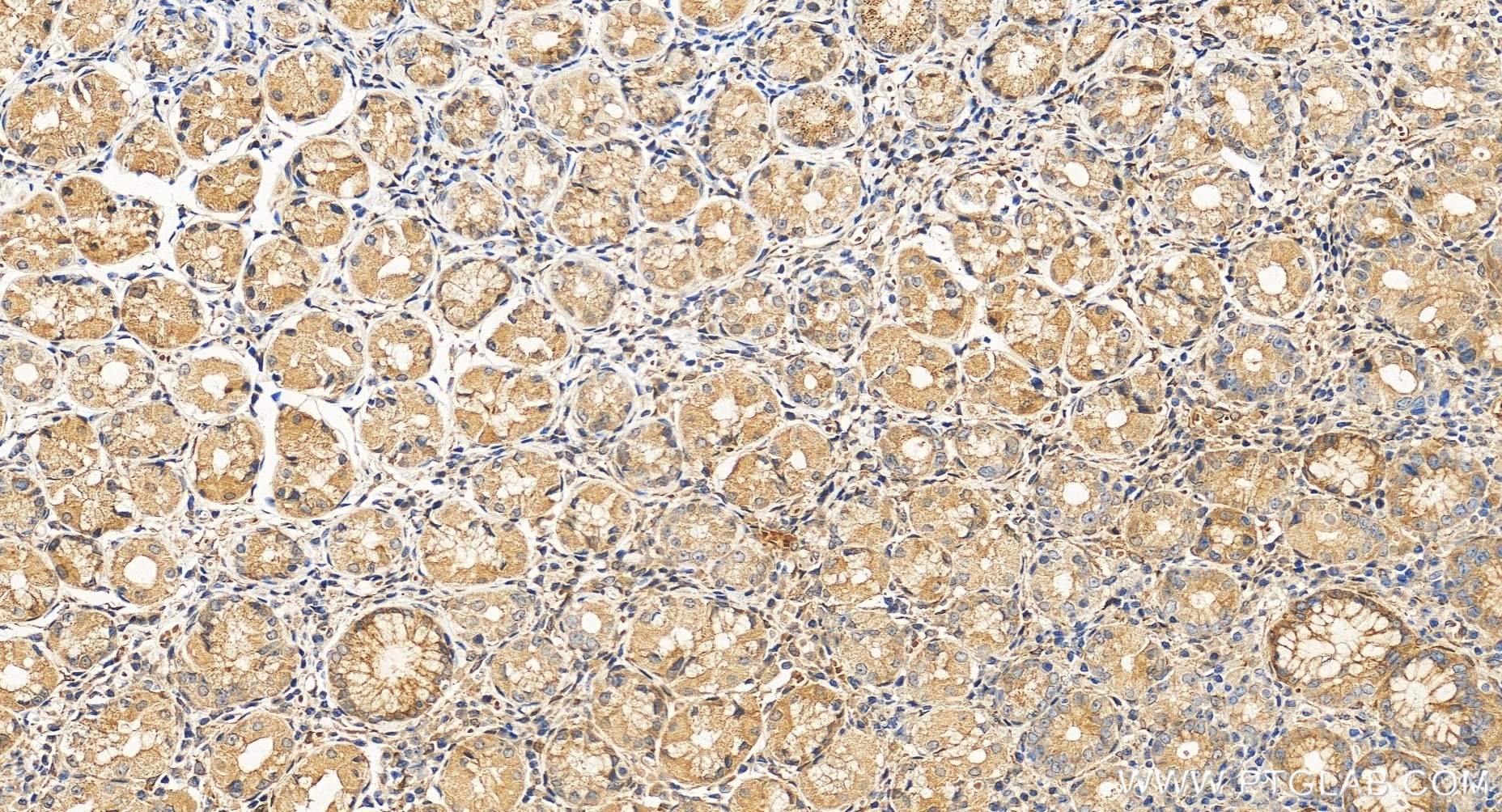 Immunohistochemical analysis of paraffin-embedded human stomach tissue slide using 85120-1-RR (GPX8 antibody) at dilution of 1:2500 (under 20x lens). Heat mediated antigen retrieval with Tris-EDTA buffer (pH 9.0). Immunohistochemistry (IHC) staining of human stomach tissue using GPX8 Recombinant monoclonal antibody (85120-1-RR)