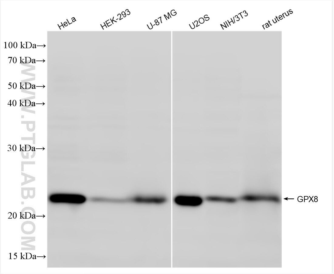 Western Blot (WB) analysis of various lysates using GPX8 Recombinant antibody (85120-1-RR)