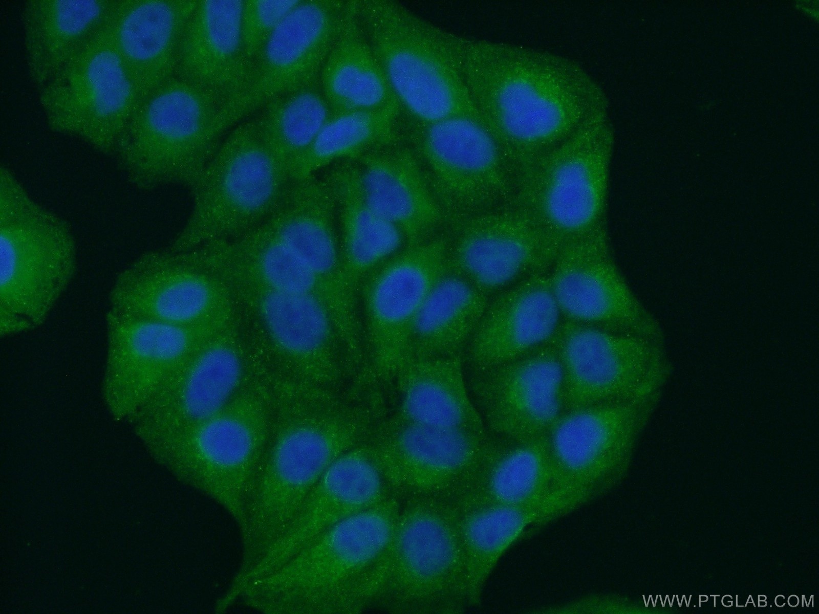 Immunofluorescence (IF) / fluorescent staining of A549 cells using GRAMD1B Polyclonal antibody (24905-1-AP)