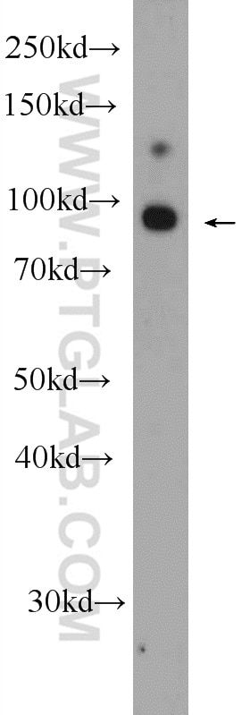 Western Blot (WB) analysis of A549 cells using GRAMD1B Polyclonal antibody (24905-1-AP)