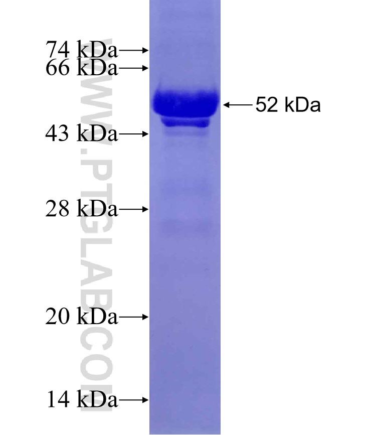 GRAMD1B fusion protein Ag20670 SDS-PAGE