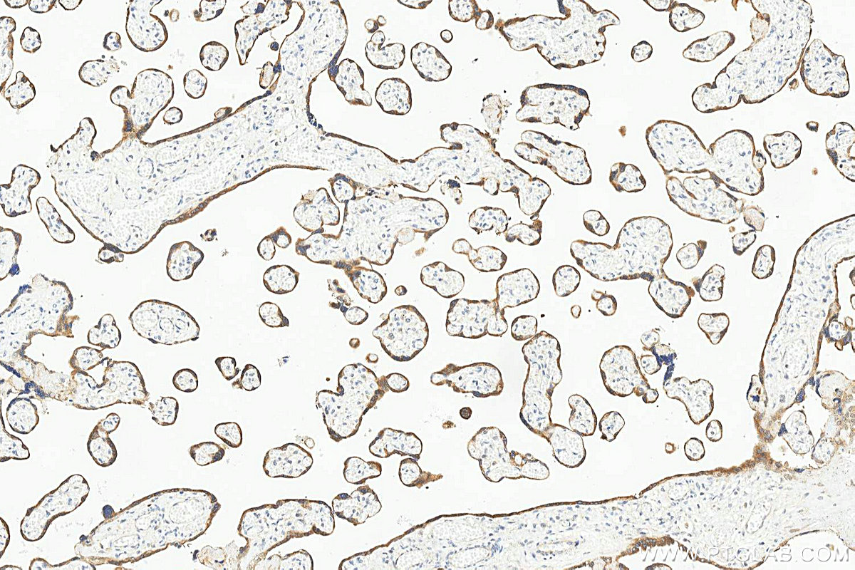 IHC staining of human placenta using 25545-1-AP Immunohistochemistry (IHC) staining of human placenta tissue using GRAMD3 Polyclonal antibody (25545-1-AP)