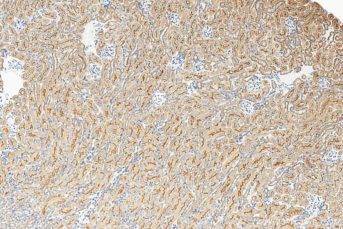 IHC staining of mouse kidney using 25545-1-AP Immunohistochemistry (IHC) staining of mouse kidney tissue using GRAMD3 Polyclonal antibody (25545-1-AP)
