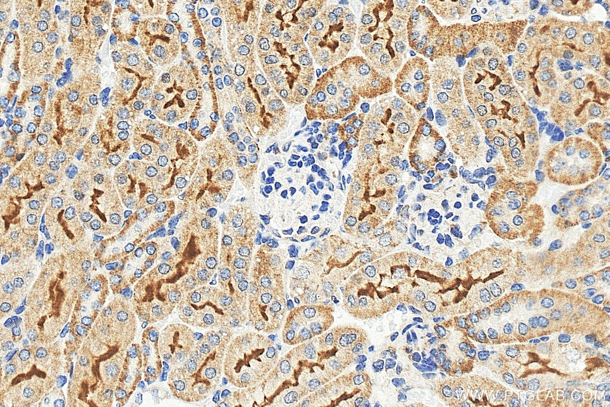 IHC staining of mouse kidney using 25545-1-AP Immunohistochemistry (IHC) staining of mouse kidney tissue using GRAMD3 Polyclonal antibody (25545-1-AP)