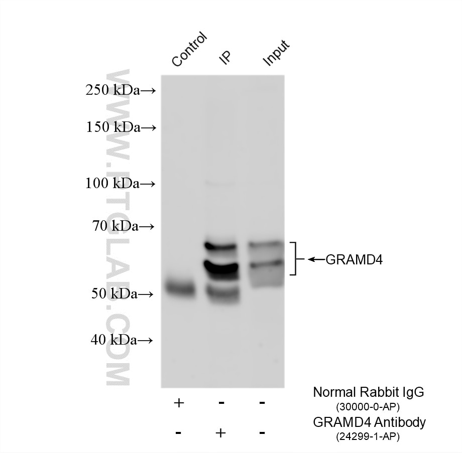 Immunoprecipitation (IP) experiment of Jurkat cells using GRAMD4 Polyclonal antibody (24299-1-AP)