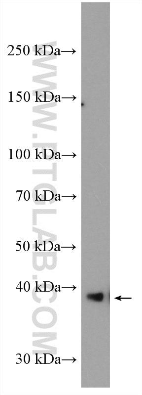Western Blot (WB) analysis of K-562 cells using GRAP2 Polyclonal antibody (11894-1-AP)