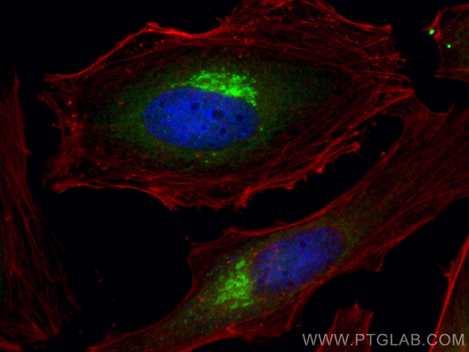 Immunofluorescence (IF) / fluorescent staining of HeLa cells using GRASP65,GORASP1 Polyclonal antibody (10747-2-AP)